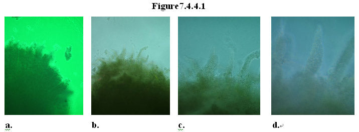 MEBO HBRRS - CLINICAL APPLICATION for Gastrointestinal regeneration IV